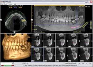 terapia de la aplicación de ADN