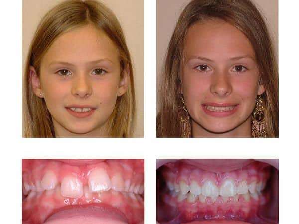holistic orthodontist expanders